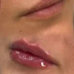 استخدام پزشک عمومی جهت مسئول فنی و مسلط به امور زیبایی دارای پروانه قرچک