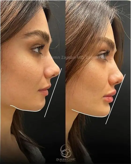 استخدام منشی و ادمین مطب زیبایی در تهران