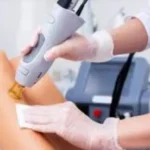 استخدام اپراتور لیزر موهای زائد در رودهن