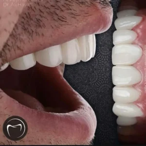 استخدام ادمین و مسئول تولید محتوا کلینیک دندانپزشکی در کرج
