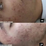 فیشیال کار هستم جویای کار در مطب و یا کلینیک بصورت پاره وقت و درصدی در تبریز