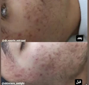 فیشیال کار هستم جویای کار در مطب و یا کلینیک بصورت پاره وقت و درصدی در تبریز