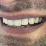 استخدام دستیار دندانپزشک جهت کلینیک در تهران