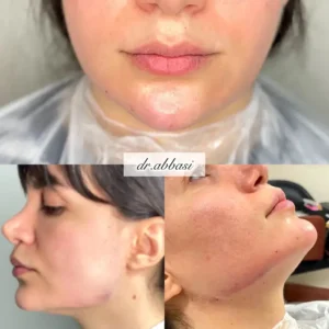 پزشک زیبایی آقا هستم مایل به همکاری با کلینیکها و مراکز زیبایی در اصفهان