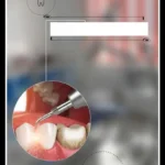 استخدام نیروی پذیرش و دستیار دندانپزشک در گرگان