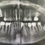 استخدام منشی و دستیار دندانپزشکی جهت کلینیک در میرداماد تهران