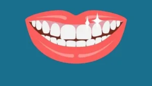 استخدام دستیار دندانپزشکی جهت مطب در تبریز
