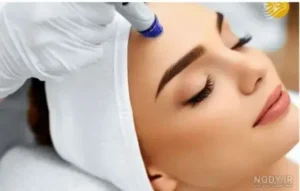 استخدام اپراتور لیزر جهت کلینیک زیبایی در ایذه