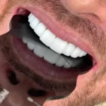 استخدام دستیار دندانپزشک و نیروی پذیرش با تجربه در تهران