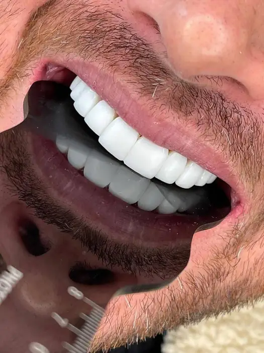 استخدام دستیار دندانپزشک و نیروی پذیرش با تجربه در تهران