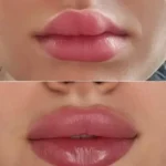 استخدام پزشک زیبایی دارای پروانه کرج