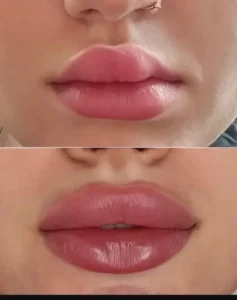 استخدام پزشک زیبایی دارای پروانه کرج