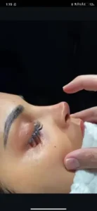 استخدام جراح متخصص ent یا جراح پلاستیک در تهران