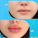 استخدام پزشک عمومی مسلط به امور زیبایی جهت مطب تازه تاسیس در تهران