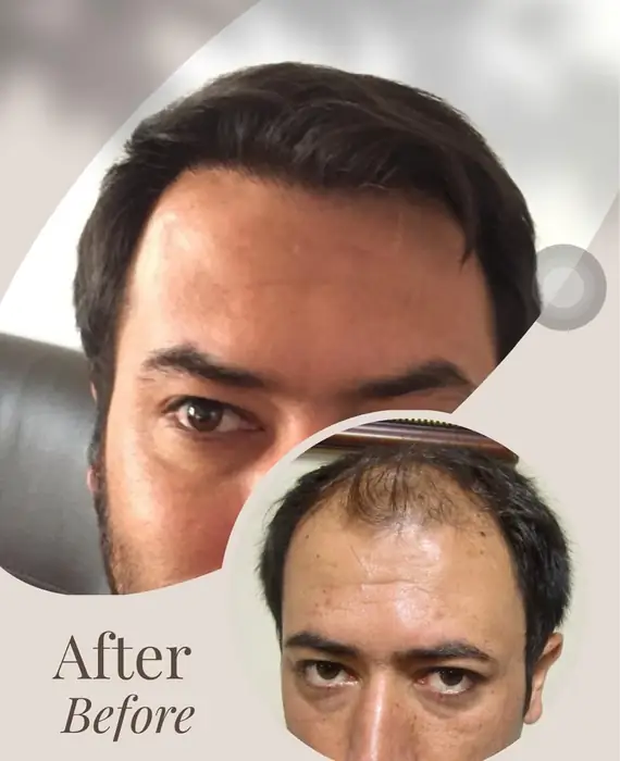 استخدام پزشک متخصص پوست و مو دارای پروانه تهران