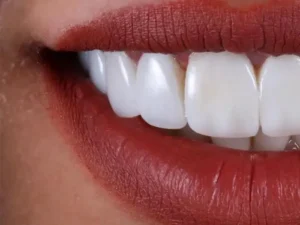 استخدام منشی خانم برای کلینیک دندانپزشکی در اردبیل *