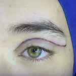 استخدام جراح مسلط به امور زیبایی در تهران