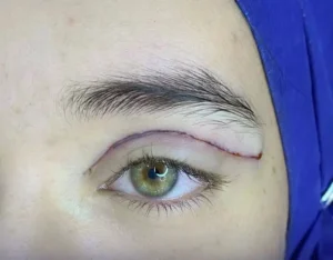 استخدام جراح مسلط به امور زیبایی در تهران