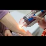 استخدام اپراتور لیزر خانم در برازجان