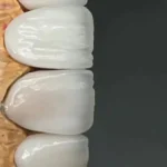استخدام منشی و دستیار دندانپزشکی در یزد