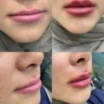 استخدام پزشک عمومی به عنوان مسئول فنی کلینیک زیبایی و دارای پروانه اندیشه