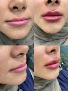 استخدام پزشک عمومی به عنوان مسئول فنی کلینیک زیبایی و دارای پروانه اندیشه