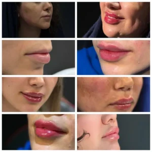 استخدام ادمین جهت کلینیک زیبایی در تهرانسر تهران