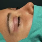 استخدام پزشک متخصص و فوق تخصص چشم جهت مرکز جراحی در قیطریه تهران