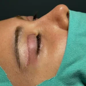 استخدام پزشک متخصص و فوق تخصص چشم جهت مرکز جراحی در قیطریه تهران