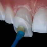 استخدام دستیار و منشی دندانپزشک در بندر عباس