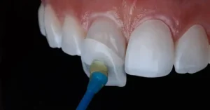استخدام دستیار و منشی دندانپزشک در بندر عباس