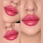 استخدام پزشک زیبایی دارای پروانه کرج
