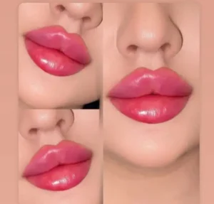 استخدام پزشک زیبایی دارای پروانه کرج