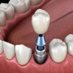استخدام دستیار و پذیرش جهت کلینیک دندانپزشکی در اندیشه