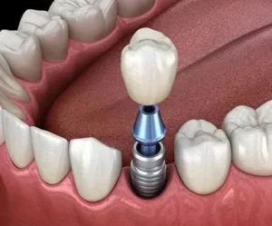 استخدام دستیار و پذیرش جهت کلینیک دندانپزشکی در اندیشه