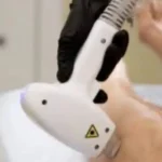 استخدام اپراتور لیزر و فیشیالیست جهت مطب زیبایی در زرند کرمان