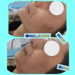 پزشک عمومی دارای دستگاه لیزر هستم مسلط به تزریقات زیبایی آماده همکاری با کلینیک های زیبایی در اصفهان