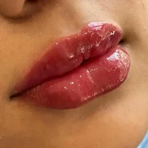 استخدام منشی و اپراتور لیزر جهت مطب پوست و زیبایی در تبریز