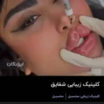 استخدام دستیار پزشک زیبایی جهت کلینیک در تهران