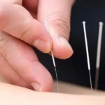 واگذاری مطب مجهز طب سوزنی در بلوار فردوسی مشهد