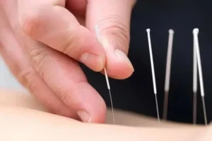واگذاری مطب مجهز طب سوزنی در بلوار فردوسی مشهد