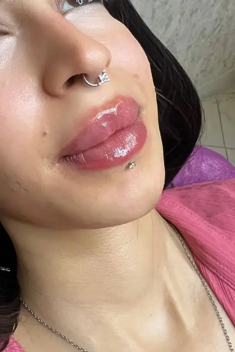پزشک زیبایی هستم مسلط به امور زیبایی مایل به همکاری با کلینیک های تهران