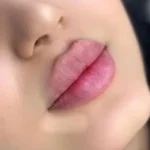 پزشک عمومی هستم جویای کار در مراکز زیبایی اصفهان
