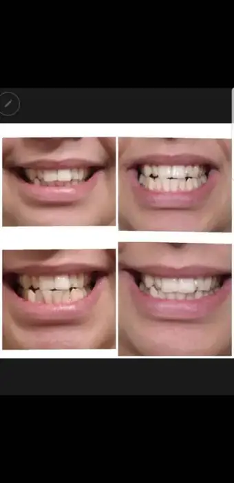 استخدام منشی و دستیار دندانسازی در جنت آباد تهران