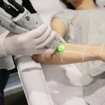 استخدام اپراتور لیزر کندلا در سعادت آباد اصفهان