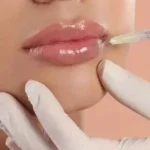 نیازمند دستیار پزشک کاملاً مسلط به انجام تزریقات زیبایی در امانیه تهران