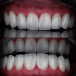 نیازمند منشی و دستیار جهت مطب دندانپزشکی در عمار یاسر قم