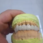 استخدام دستیار یا منشی جهت مطب دندانپزشکی شخصی در علی آباد قم