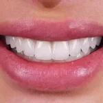 استخدام دستیار و منشی جهت کلینیک دندانپزشکی در ونک تهران