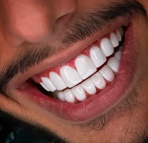 استخدام منشی و دستیار خانم جهت کلینیک دندانپزشکی در فردیس کرج